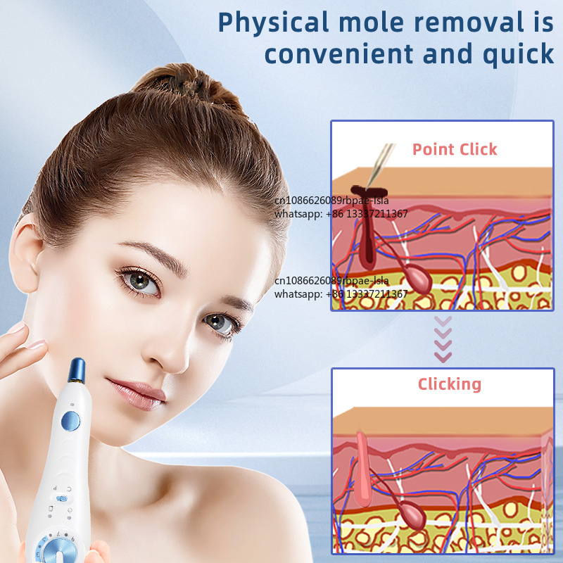 قلم البلازما 500 هرتز لشد الجل - مراجعة Plasma Pen Fibroblast Eyelid Lift وسعره