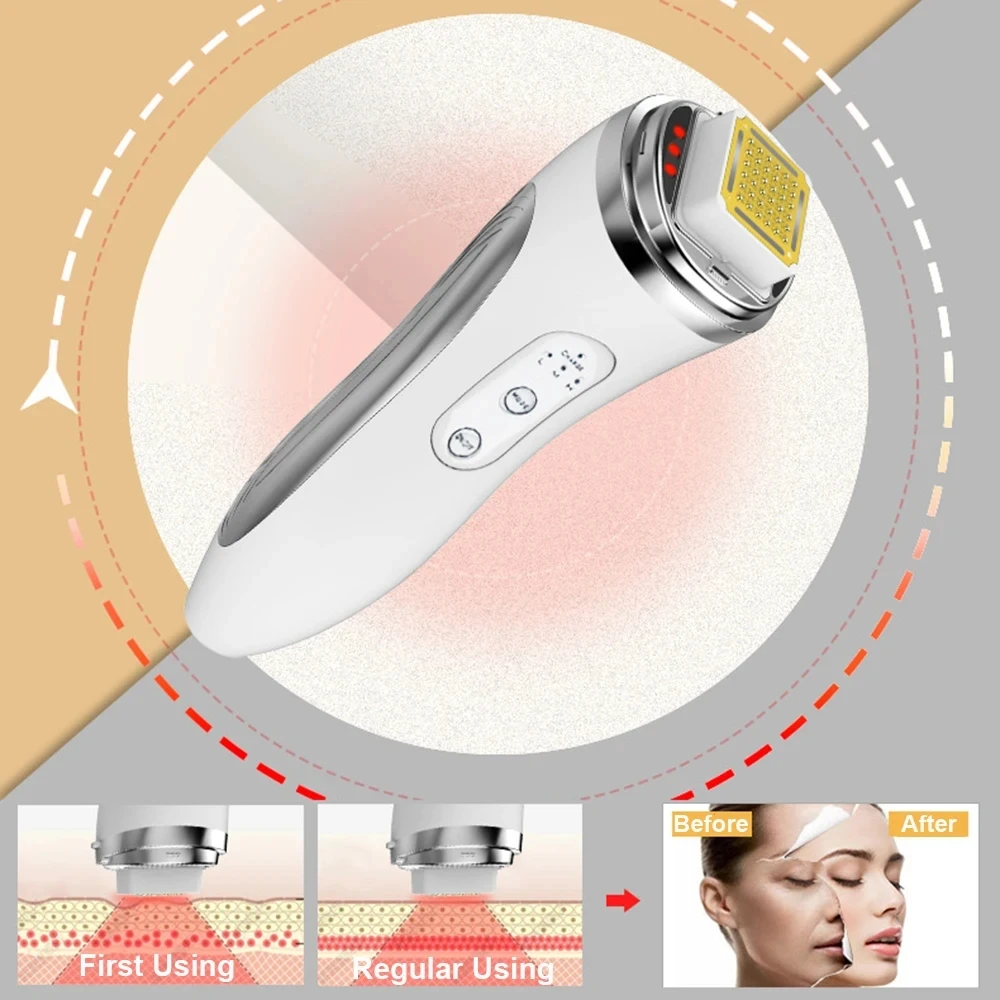 جهاز رفع الوجه بالترددات الراد - مراجعة Radio Frequency Face Lift Machine وسعره