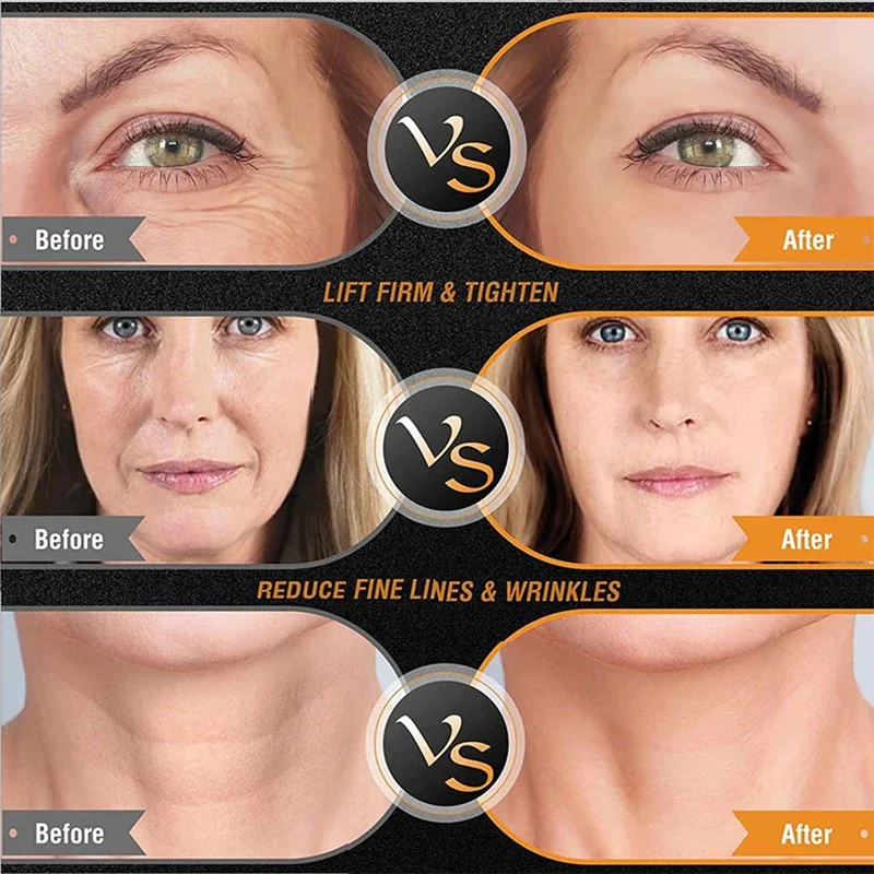 2 في 1 RF ثلاثي الأقطاب آلة رف - مراجعة Radio Frequency Face Lift Machine وسعره