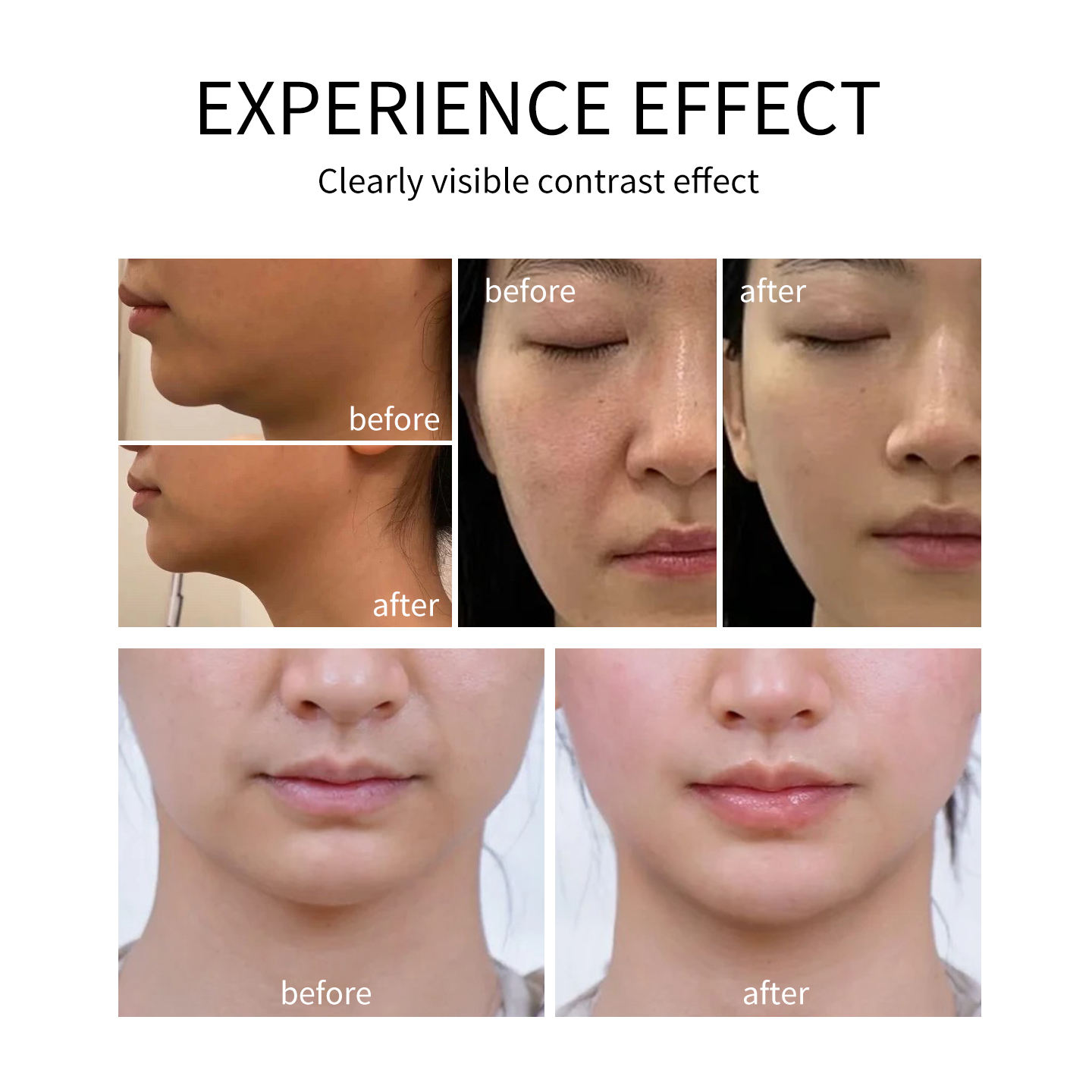 جهاز احترافي لشد البشرة بتردد  - مراجعة Radio Frequency Face Lift Machine وسعره