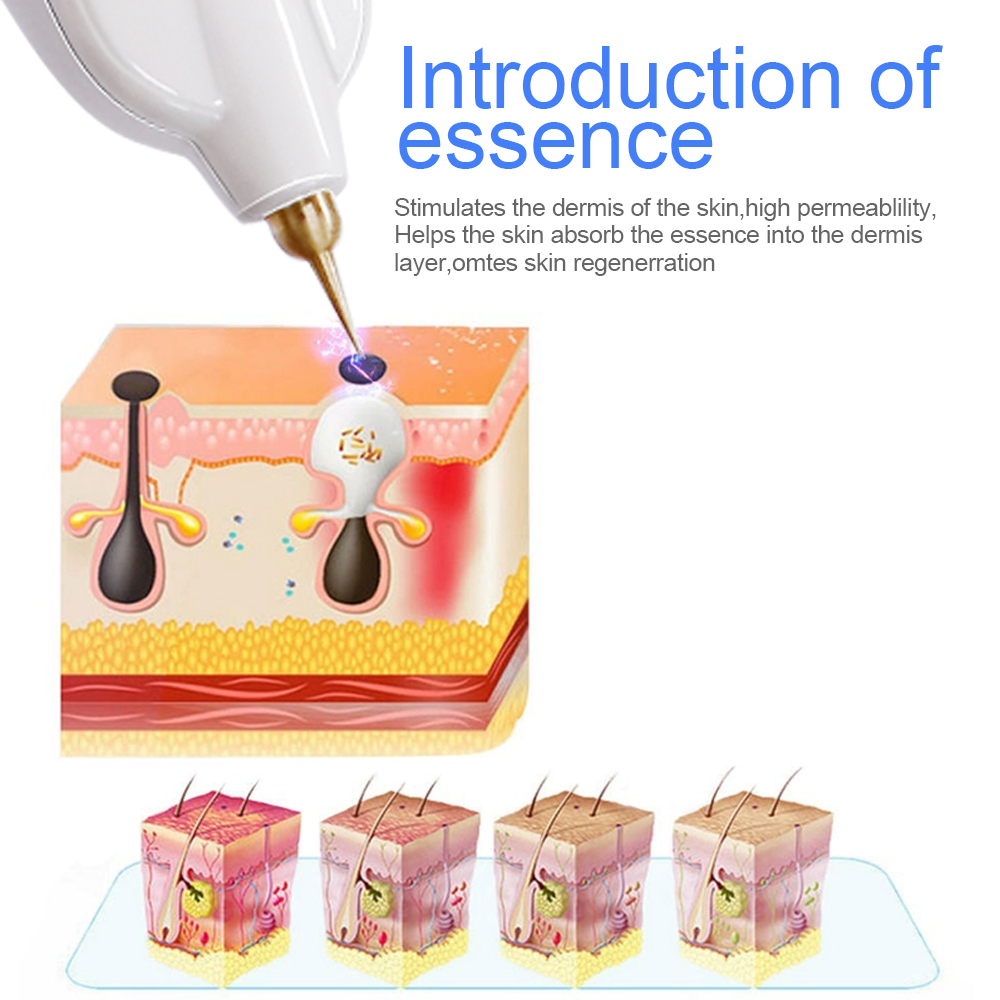 رأس إبرة نحاسي بديل لقلم البلا - مراجعة Plasma Pen Fibroblast Eyelid Lift وسعره