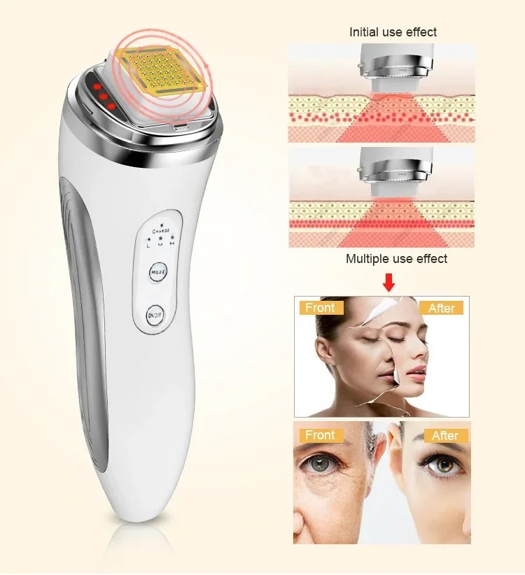 جهاز العناية بالوجه يعمل بموجا - مراجعة Radio Frequency Face Lift Machine وسعره
